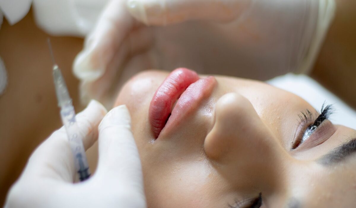 how-long-does-lip-filler-last