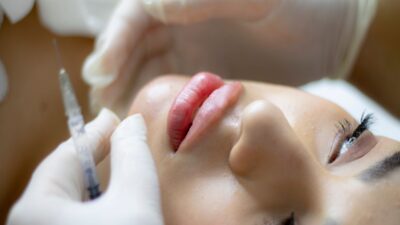 how-long-does-lip-filler-last